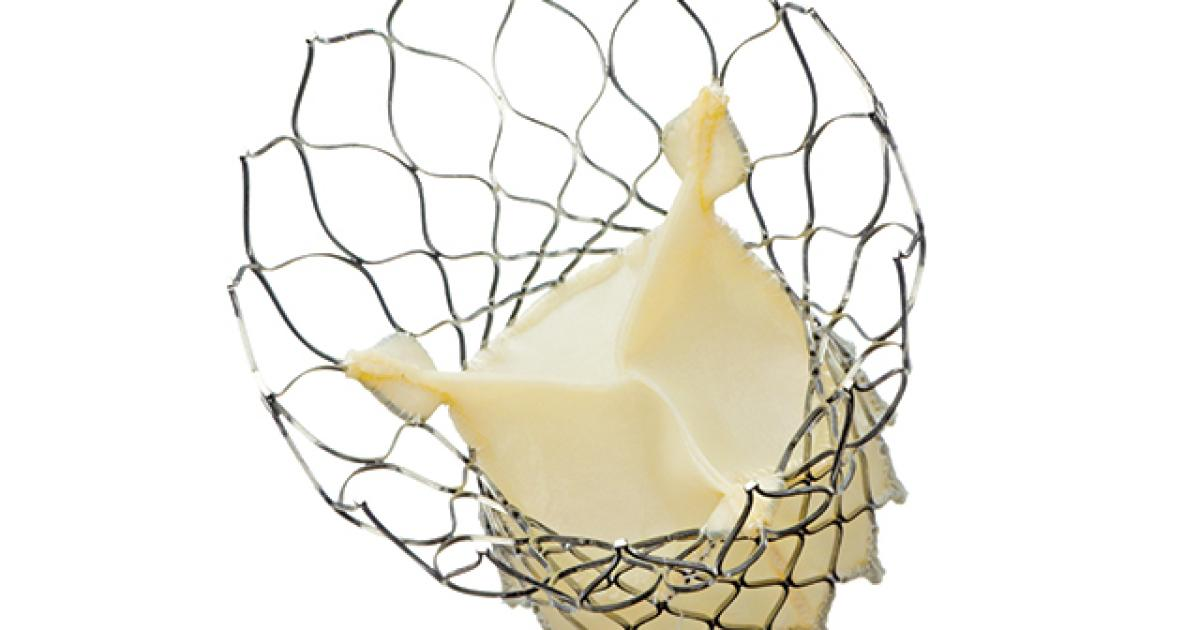 Valve MedTronics Corevalve - Chirurgiens Cardiaques Associés à Caen